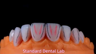 Standard Dental Lab Co., Limited linha de produção do fabricante
