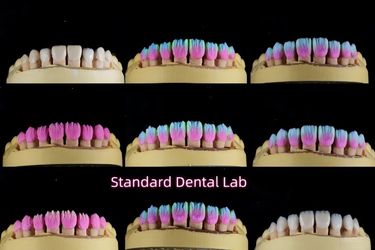 Standard Dental Lab Co., Limited linha de produção do fabricante
