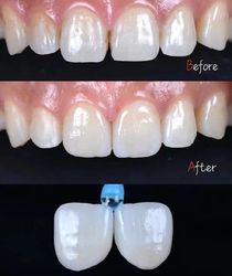 Standard Dental Lab Co., Limited linha de produção do fabricante