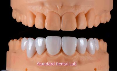 Standard Dental Lab Co., Limited linha de produção do fabricante