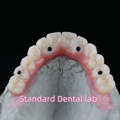 comprar Porcelana Zirconia Implantação Dental Ponte Profissional Alta Estética Com Goma Rosa fabricação em linha