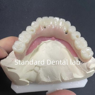 comprar Restauração Estética Todos em 4 Implantes Dentários Circonia Hipalergênica fabricação em linha