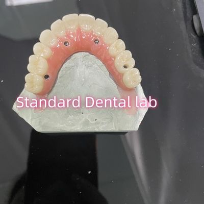 comprar All On Four Six Ivoclar Zirconia Implant Bridge Bar de Titânio com porcelana de goma rosa fabricação em linha
