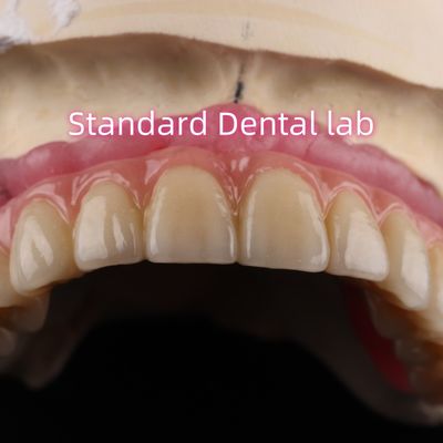 comprar Cimento Rápido e Implantação de Produtos Dentários de Circônia Coronas Ponte fabricação em linha