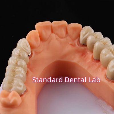 comprar Coroa digital de porcelana de metais não preciosos PFM ponte dentária fabricação em linha