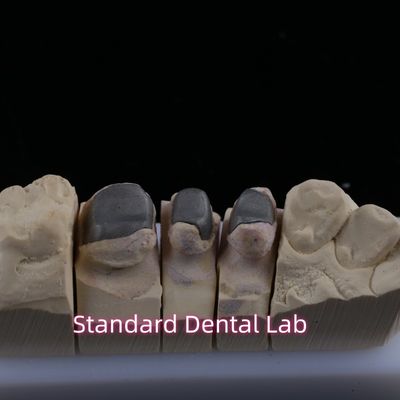 comprar Metal fundido Post Core Crown Cocr Retentive Precise Full Zirconia Bruxier fabricação em linha