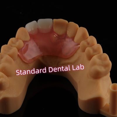 comprar Dentário Valplast Dentes flexíveis de barbatanas Dentes parciais removíveis fabricação em linha