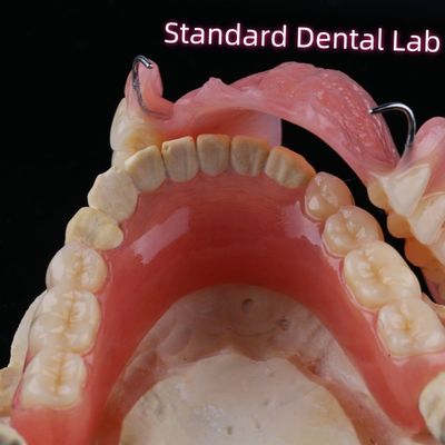 comprar Restaurações dentárias removíveis Dentes de prótese parcial acrílica com grampos de arame fabricação em linha