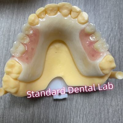 comprar Quadro Acetálico Clap Acrílico Dentes Parciais Removíveis fabricação em linha