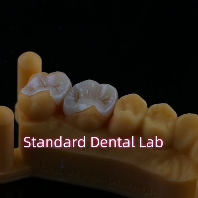 comprar Resina composta Zirconia Emax Metal Inlay Onlay Overlay fabricação em linha