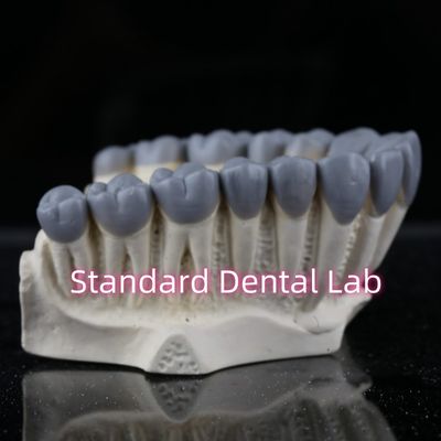 comprar SDL Dental Lab Diagnóstico Digital Wax Ups Crown Bridge fabricação em linha