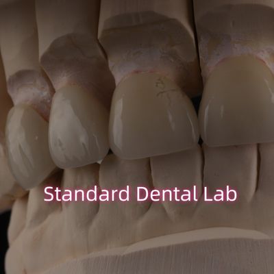 comprar Laboratório Dental Profissional Coroa de Zircônio para Restauração Fixa fabricação em linha