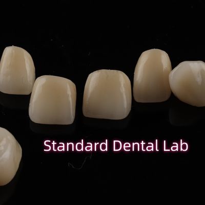 comprar Coroas dentárias de zircônio de camadas fortes Restauração completa do arco superior fabricação em linha