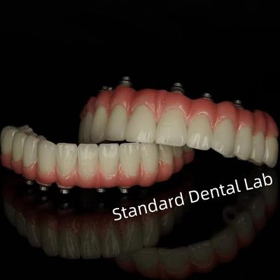 comprar Implantes de cimento de parafuso Restaurações dentárias retidas do laboratório dentário padrão fabricação em linha