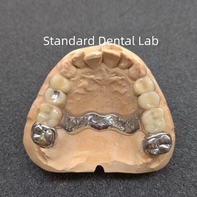 comprar Dentista Dentária Removível de Precisão Dentária Parcial Profissional Estável fabricação em linha