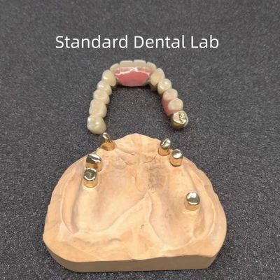 comprar CAD CAM Dente Parcial Dentadura Aplicação Dentário Profissional Precisa fabricação em linha
