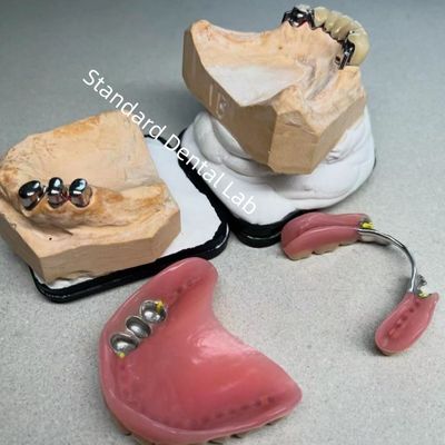 comprar Alta Estética CAD CAM Dente Parcial Dentadura Aplicação Substituição Laboratório Odontológico Padrão fabricação em linha