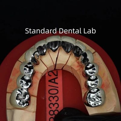 comprar Coroas de porcelana de metal de arco completo / ponte de coroa dental estética PFM precisa fabricação em linha