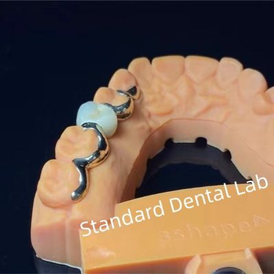 comprar Dentes Dentários PFM Maryland Bridge Alta Estética Certificado FDA fabricação em linha