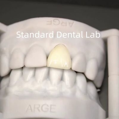 comprar Coroas digitais de laboratório dental CAD CAM Coroa de zircônio translúcida em camadas fabricação em linha