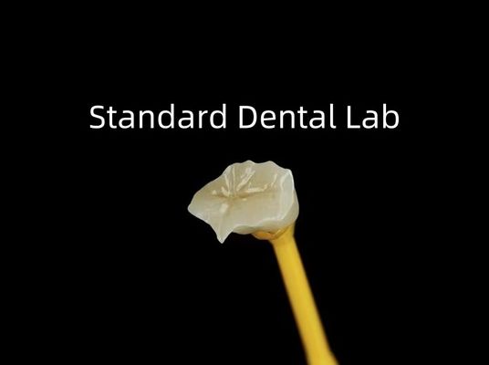comprar Dental Porcelana Inlay Onlay Zirconia Emax Alta Estética fabricação em linha