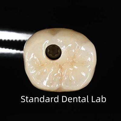 comprar Coroa de implante dentário retida por parafuso fabricação em linha
