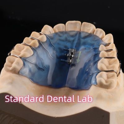 comprar Aparelho de expansão do palato removível Profissional de ortodontia para maxilar mandibular fabricação em linha