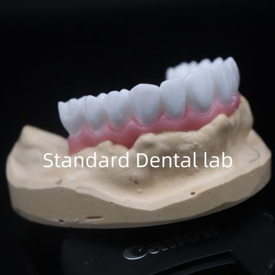 comprar Alta Estética Coroa Dental Branca Diagnóstico Cereja Personalizada Laboratório Dental da China fabricação em linha
