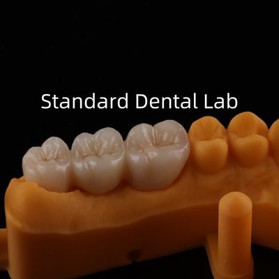 comprar Coroas de porcelana de metal Be Ni Precise Estética PFM Coroa Dental fabricação em linha