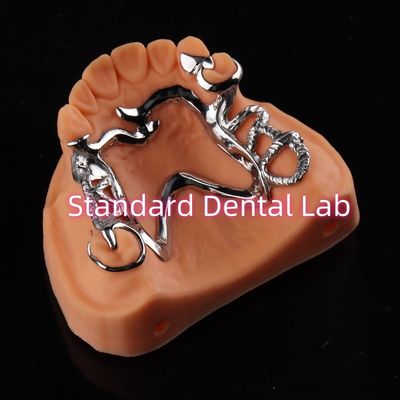 comprar Cobalt Chrome Framework Ni Be Free prótese dentária removível China Dental Lab fabricação em linha