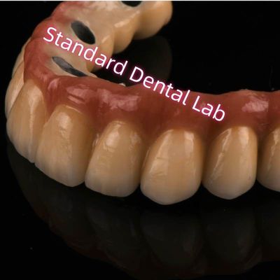 comprar Cobalt Chrome Ivoclar Laser Sinterizado PFM Crown Metal Porcelana Bridge A1 A2 A3 fabricação em linha