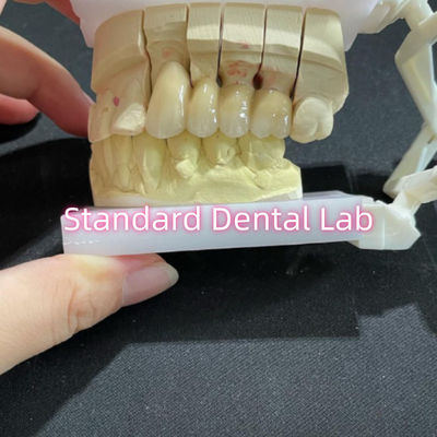 comprar PFM não precioso CoCr Metal Porcelana Ponte Dental CCM fabricação em linha