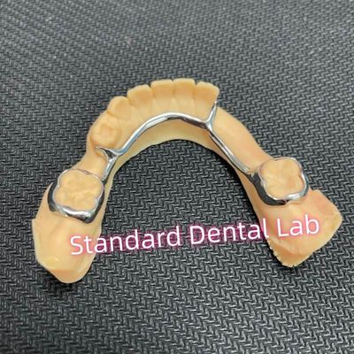 comprar Mantenedor de espaço bilateral dentário para dentes ausentes Arco de retenção lingual fabricação em linha