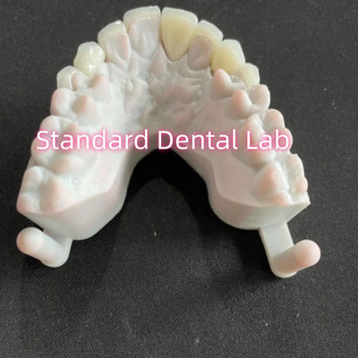 comprar Star's Smile Dental Teeth Emax Zirconia Laminate Veneers 0,6mm fabricação em linha