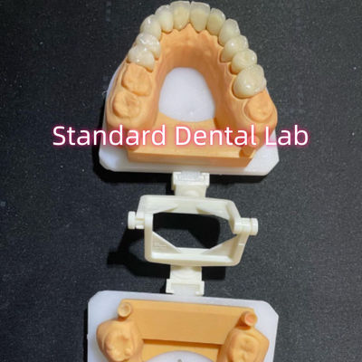 comprar Dentista Restaurador Odontologia Cuidados orais Coroa completa de zircônio personalizada fabricação em linha