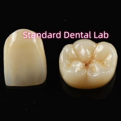 comprar Biocompatibilidade Materiais Estéticos Coroa de Zirconia Coroa de Zirconia Dentes de Ponte fabricação em linha
