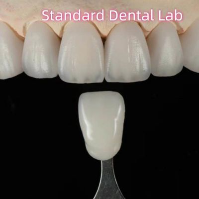 comprar Ponte Dental de Circônia de Aidita de Alta Estética Natural Personalizada fabricação em linha
