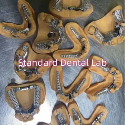 comprar Dentes parciais de estrutura metálica fundida de cobalto-cromo removível fabricação em linha