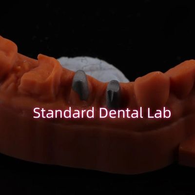 comprar Coroa de núcleo de pós-metal CAD CAM Porcelana / Zirconia Coping Full Zircnonia Bruxier Coroas fabricação em linha