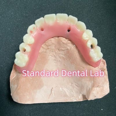 comprar Implante parcial de acrílico sobre dentadura de titânio barra dentadura completa Dentes montados para o parafuso retido fabricação em linha