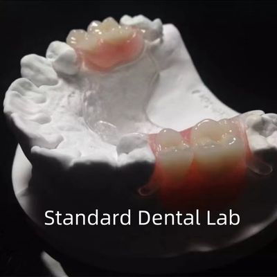 comprar Estrutura de metal fundido transparente flexível Dentes parciais Alta estética Perfeito ajuste fabricação em linha