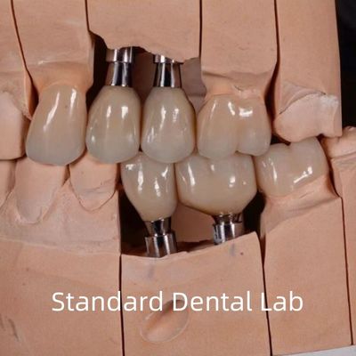 comprar Coroa de implante de zircônio estética de aparência natural fabricação em linha
