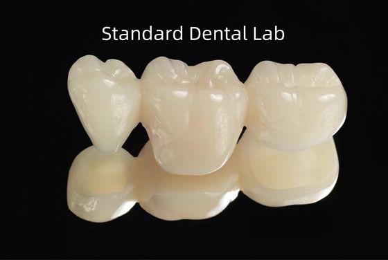 comprar CAD CAM PMMA vazio ponte temporária dentária provisória fabricação em linha