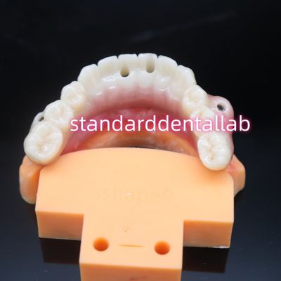 comprar Ponte de implante dentário de zircônio biocompativel fabricação em linha