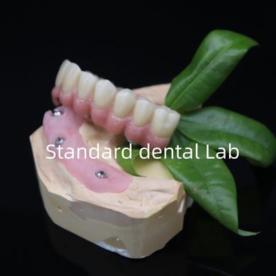 comprar Atravessado em 6 pontes de zircônio dentárias de alta precisão sobre a base de Ti fabricação em linha