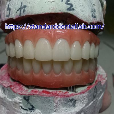 comprar Implante Dental Coroa Temporária PMMA Ponte Com Porcelana Rosa fabricação em linha