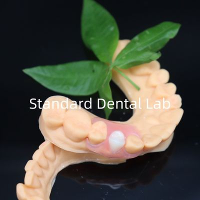 comprar Dentes flexíveis estéticos Valplast com política de reposição gratuita em 3 dias China Dental Lab fabricação em linha