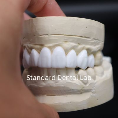 comprar Coroas Dentárias Diagnóstico depilação de cera Alta Estética do Laboratório Dental da China fabricação em linha