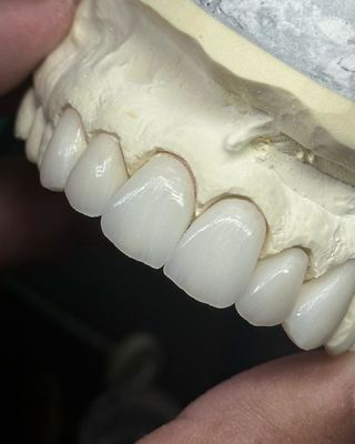 comprar Coroa de zircônio em camadas de translucidez para uma funcionalidade ótima e estética natural fabricação em linha