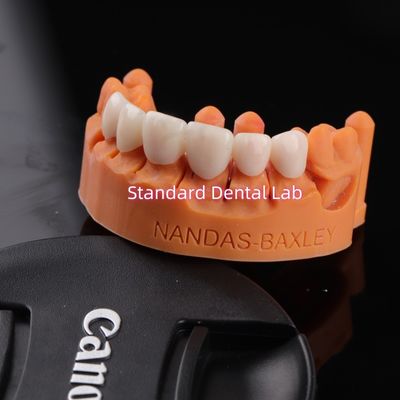 comprar Conforto e Função com Digital CAD CAM Dental Lab Translúcida Ponte de Zircônio em Camadas fabricação em linha